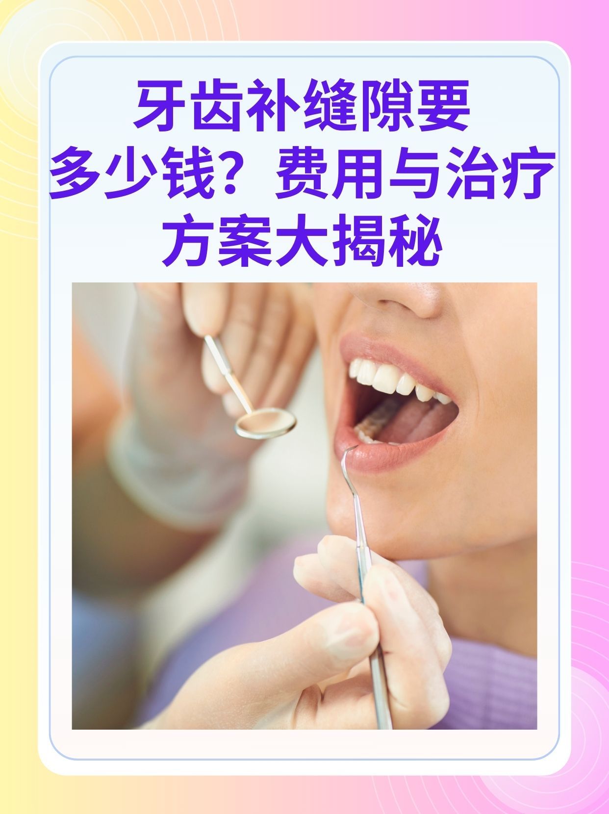 攀枝花补牙医保可以报销吗(补牙医保可以报销吗 哪些可以报销呢)